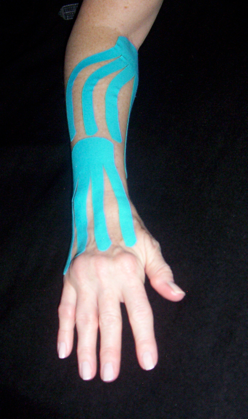 Lymph Taping & Scar Therapy Lymphatic Massage Works
